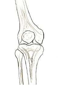 Arthrose osteopathisch betrachtet