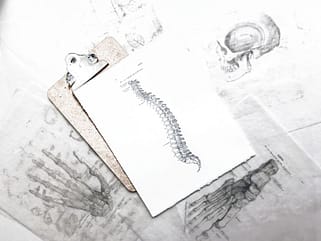 Skizze einer Wirbelsäule für die Beratung in der Osteopathie
